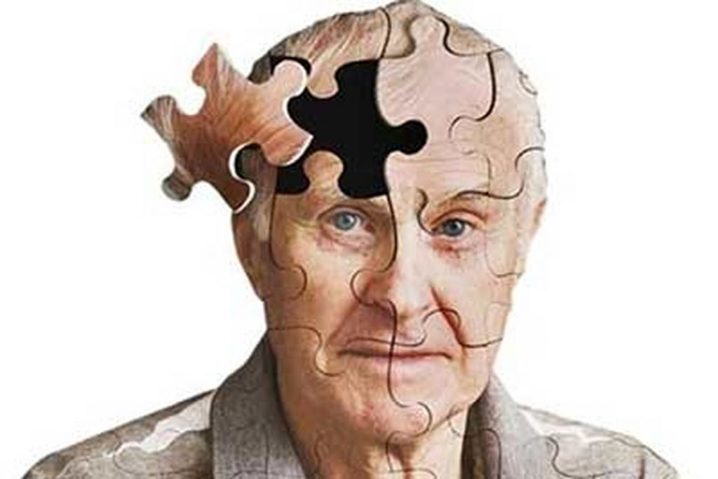 پیشگیری از آلزایمر و فراموشی