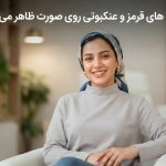 چرا رگ های قرمز روی صورت ظاهر می شوند؟